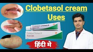 Clobetasol Propionate cream uses | Tenovate cream Uses in hindi