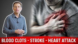 How to Prevent Blood Clots, Strokes & Heart Attacks? – Tips by Dr. Berg