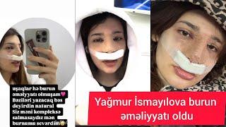 Rəksanə İsmayılovanin qızı Yağmur İsmayılova burun  əməliyyatı oldu