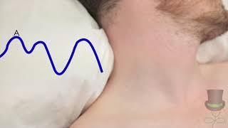 Cardiology - Assessing the Jugular Venous Pulse