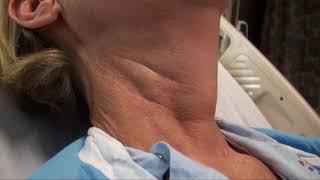 Regular Carotid Pulsation and Discernible Internal Jugular Venous Pulse