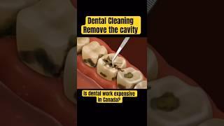 Dental costs , Check up and cleaning is it expensive in Canada?