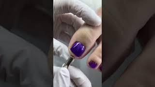 #feetnail