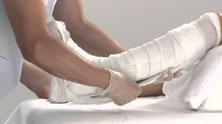 Plaster of Paris Lower Leg Splint Application