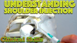 Shoulder Injection Explained - Clinical Skills - Dr James Gill