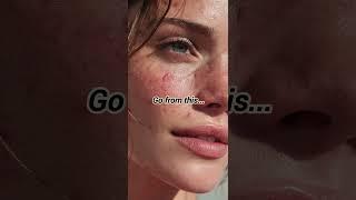#skincare #oilyskinremedy