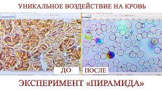 УНИКАЛЬНОЕ ВОЗДЕЙСТВИЕ НА КРОВЬ. ЭКСПЕРИМЕНТ ПИРАМИДА l  13.01.18