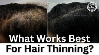 2025 Top Hair Growth Treatments That Actually Work | Dr Nivedita dadu