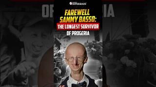 Sammy Basso’s Story & What You Need to Know About Progeria | What is Progeria Disease | #shorts