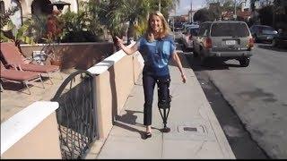 First Time Using iWALK2.0 - Kristi takes her first steps on the iWALK2.0 Hands Free Crutch