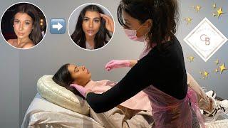 NON SURGICAL FACE LIFT AT A TOP LONDON CLINIC | My experience at Carbon Blush on Harley Street