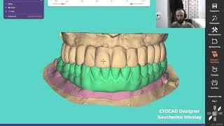 Как в exocad опустить прикус на готовой работе не переделывая ее? ответ в видео.