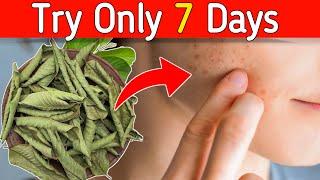 Amazing Benefits Of Guava Leaves For Skin