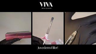 Our obsession with Juvederm never ends…  the best filler on the market  #beauty #fillers