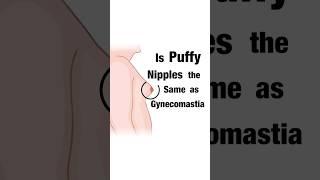 Are Puffy Nipples The Same As Gynecomastia? Dr. Aniketh Venkataram, The Venkat Center, Bengaluru