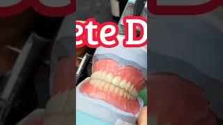 How To make  a Complete Denture|How CD get Retention|Stability of CD|CD in Prosthodontics