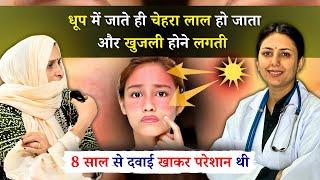 Skin Allergy Treatment - She had spent lakhs of rupees for 8 years. She was cured by Dr. Upasana'...