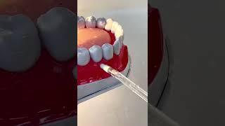 Water Flosser: Boost Your Oral Health #waterflosser #floss #dentistry