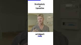 Brachioplasty vs. Liposuction Explained By Plastic Surgeon