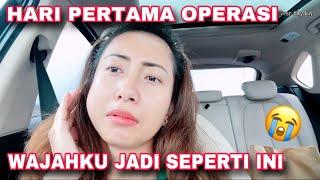 HARI PERTAMA OPERASI, WAJAHKU SAMPAI SEPERTI INI 