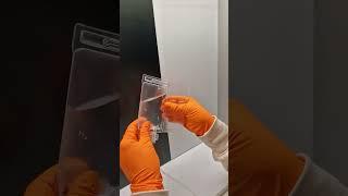 Visual Inspection of Infusion Bags