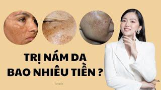 Trị nám bao nhiêu tiền ? Trần Mỹ Hiền