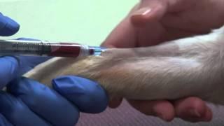 Cephalic vein phlebotomy