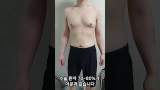 여유증 수술을 하는 환자의 대부분은 이정도 ?? #여유증 #여유증후기