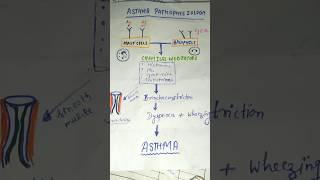 asthma pathophysiology#msn#nursing