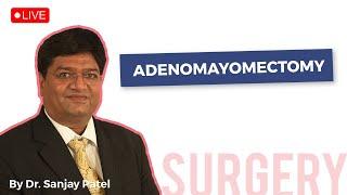Adenomayomectomy| Mayflower Women's Hospital