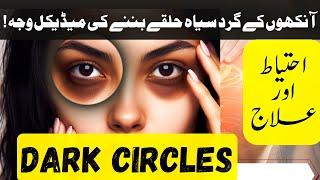 Best Care for Dark Circles | Dr. AbuBakar Bhutta