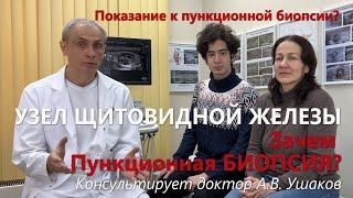 УЗИ щитовидной железы. Показание к пункции-биопсии узла /// Консультирует доктор Ушаков