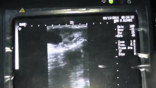 УЗД нетелей. Рука против аппарата УЗД. ultrasound heifers.