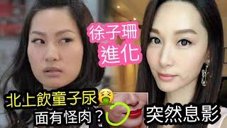 變面復出!?徐子珊「突然息影」北上吸金不成「要飲童子尿」面有怪肉！賣車賣樓「離港移民」專家分析「甚麼回事？」TVB四料港姐！事業未曾敗亡！何解不再拍戲？