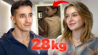 Elle pesait 28kg : son combat contre la maladie !