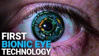 The Worlds First Bionic Eye Will Cure Blindness, New Technologies CHANGE the WORLD, Cool Technology