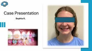 Orthodontic Case Presentation - LightForce Braces