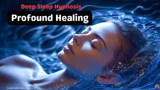 Deep Sleep Hypnosis  | Guided Meditation for Profound Healing - Use Your Powerful Mind