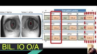 Strabismus Digatalization for Better Evaluation