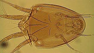 Deutonymphs of the mite Bonomoia sibirica Wirth, 2016