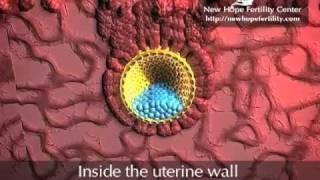 Embyro Implantation