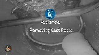 Helse Ultrasonic Endo - Post Removal - Removing Cast Posts