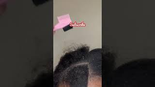 Brushing & Scratching Lots of Jumping Dandruff Flakes #asmr