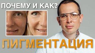 ПИГМЕНТАЦИЯ НА ЛИЦЕ КАК ПРЕДОТВРАТИТЬ? Как избежать пигментных пятен #пигментация #пигментныепятна