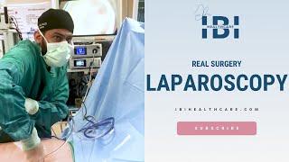 Real Surgery - Laparoscopic Surgery - IBI Healthcare Institute