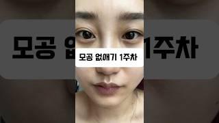모공순이들 다 나와!!!!!!!