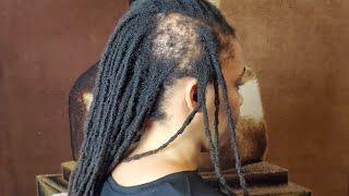 WHAT TO DO WHEN YOU'RE LOSING YOUR HAIR/LOCS