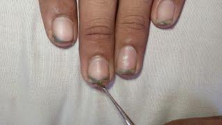"Satisfying Nail Cutting | Deep Cleaning | Relaxing Nail Care ASMR"