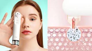 Прибор для чистки лица Xiaomi inFace Visual Blackhead Remover