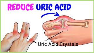 Top 11 Foods That Reduce Uric Acid Levels Naturally